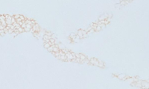 koris acrylic solid surface